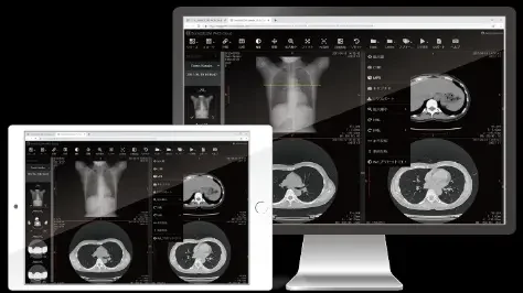 Advantages of a Web-Based DICOM Viewer